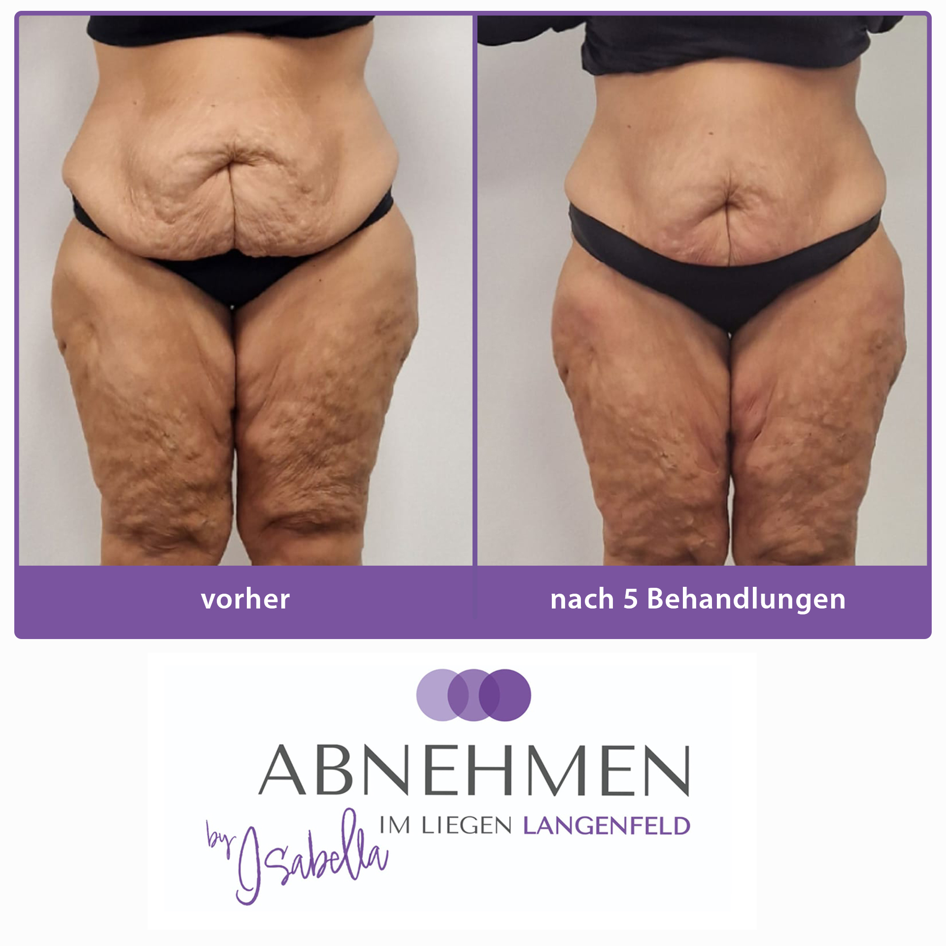 1-abnehmen-im-liegen-langenfeld-duesseldorf