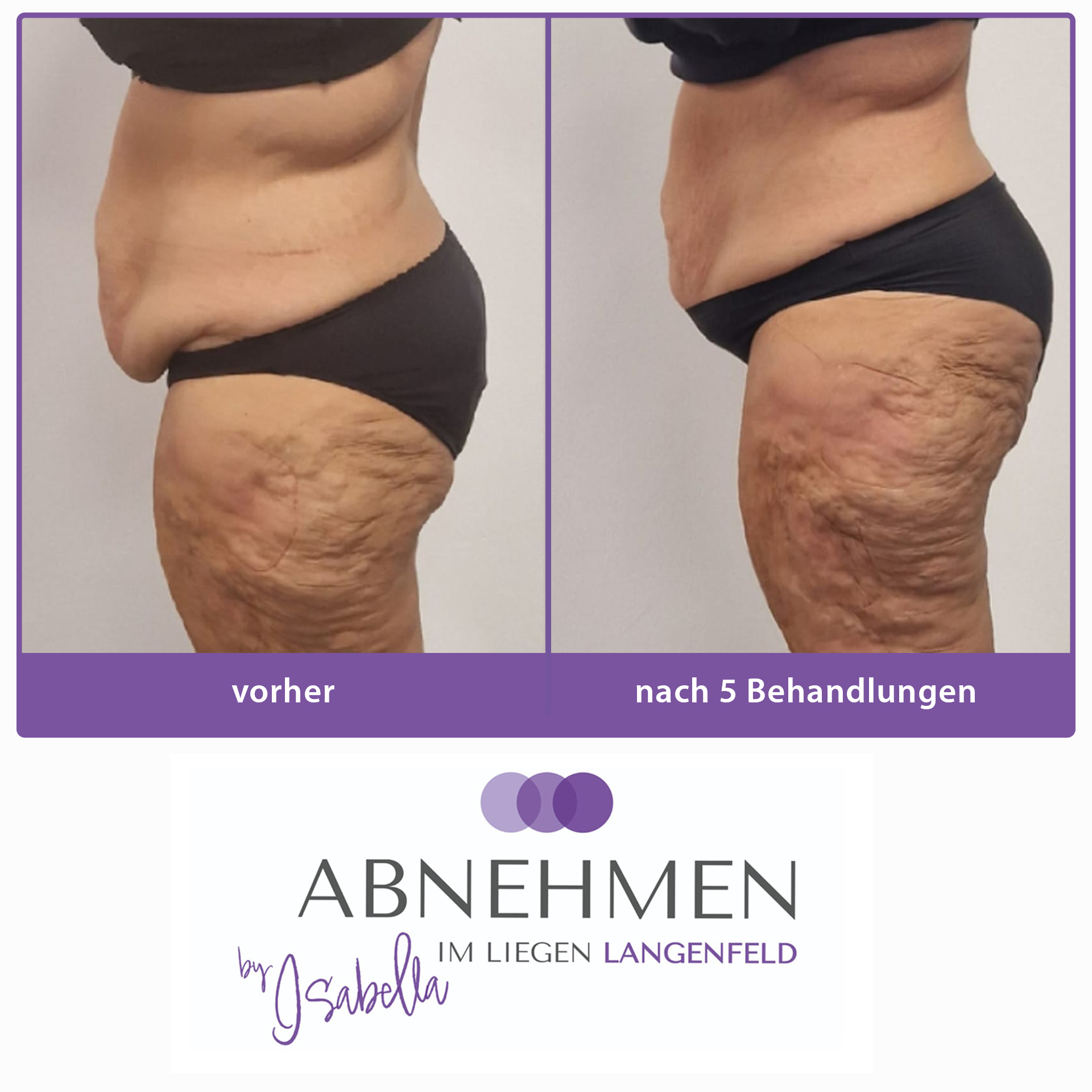 2-abnehmen-im-liegen-langenfeld-duesseldorf