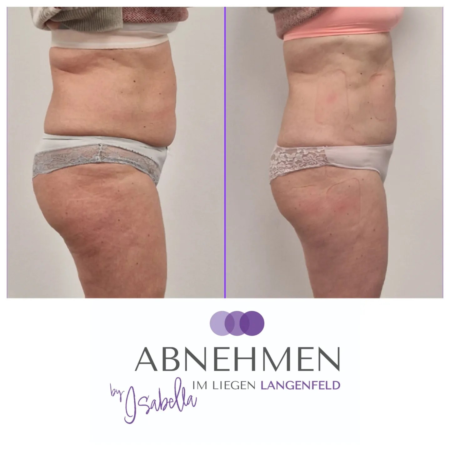 5-abnehmen-im-liegen-langenfeld-duesseldorf