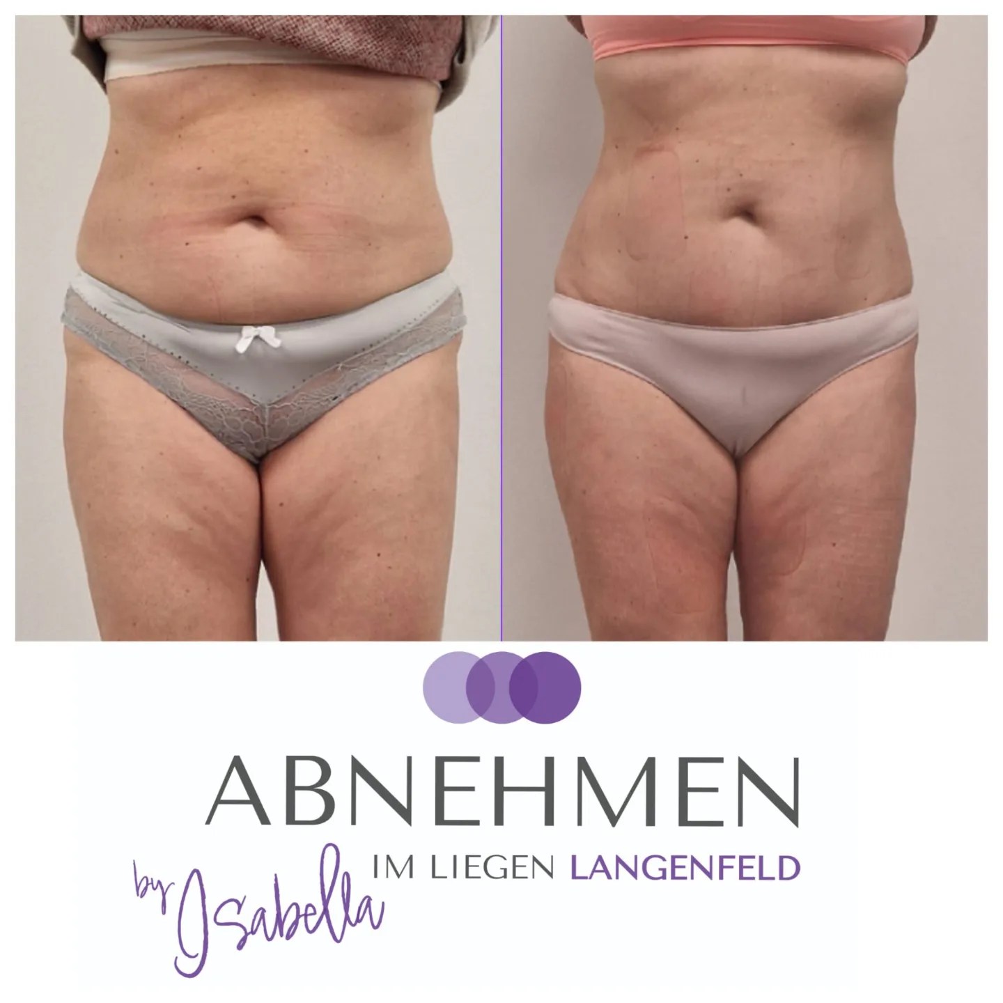 6-abnehmen-im-liegen-langenfeld-duesseldorf