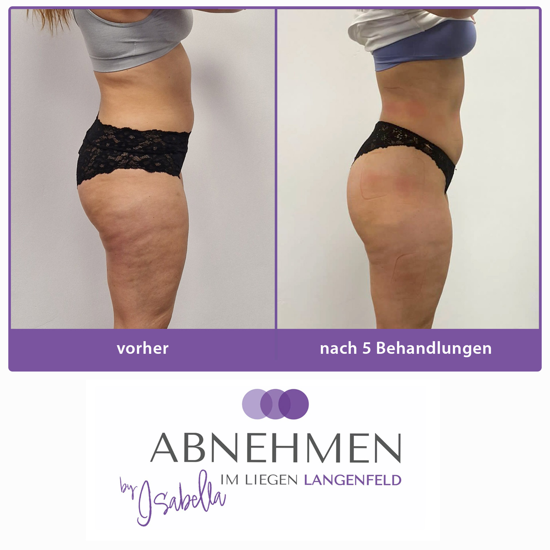 8-abnehmen-im-liegen-langenfeld-duesseldorf